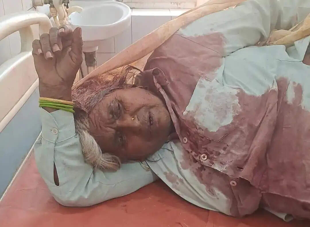 खेत जोतने को लेकर सास बहू से मारपीट