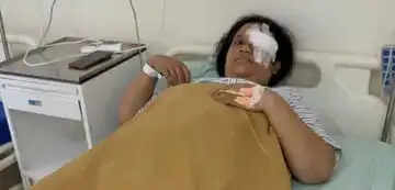 कोरबा: भारतमाला मार्ग पर बदमाशों ने चलती कार पर किया पथराव, युवती की आंख पर आई गंभीर चोट