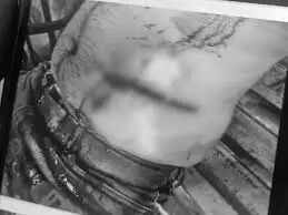 भोपाल में घूरने के विवाद में युवक पर हमला, हमीदिया अस्पताल में गंभीर हालत में भर्ती