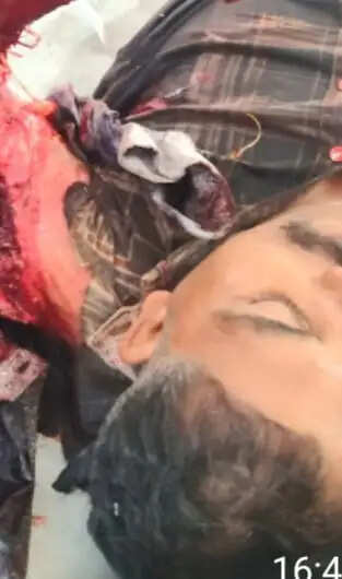 राजगढ़ः थ्रेसर मशीन की चपेट में आने से युवक गंभीर घायल, भोपाल रेफर