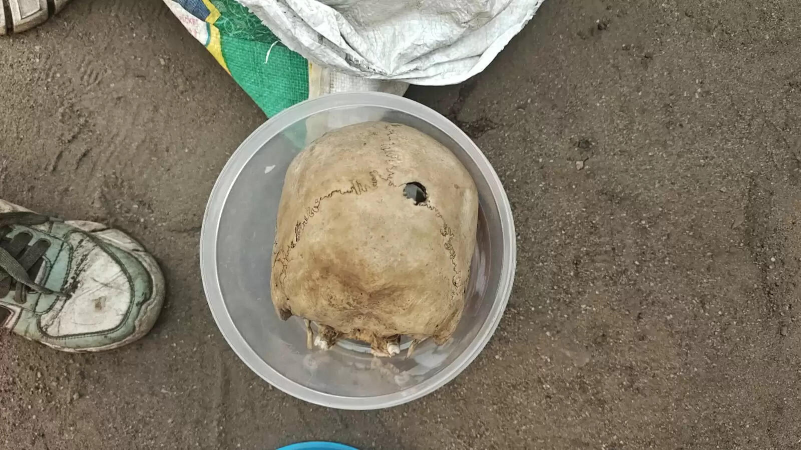 सोनू राम को सिर के पीछे मारी गई थी गोली