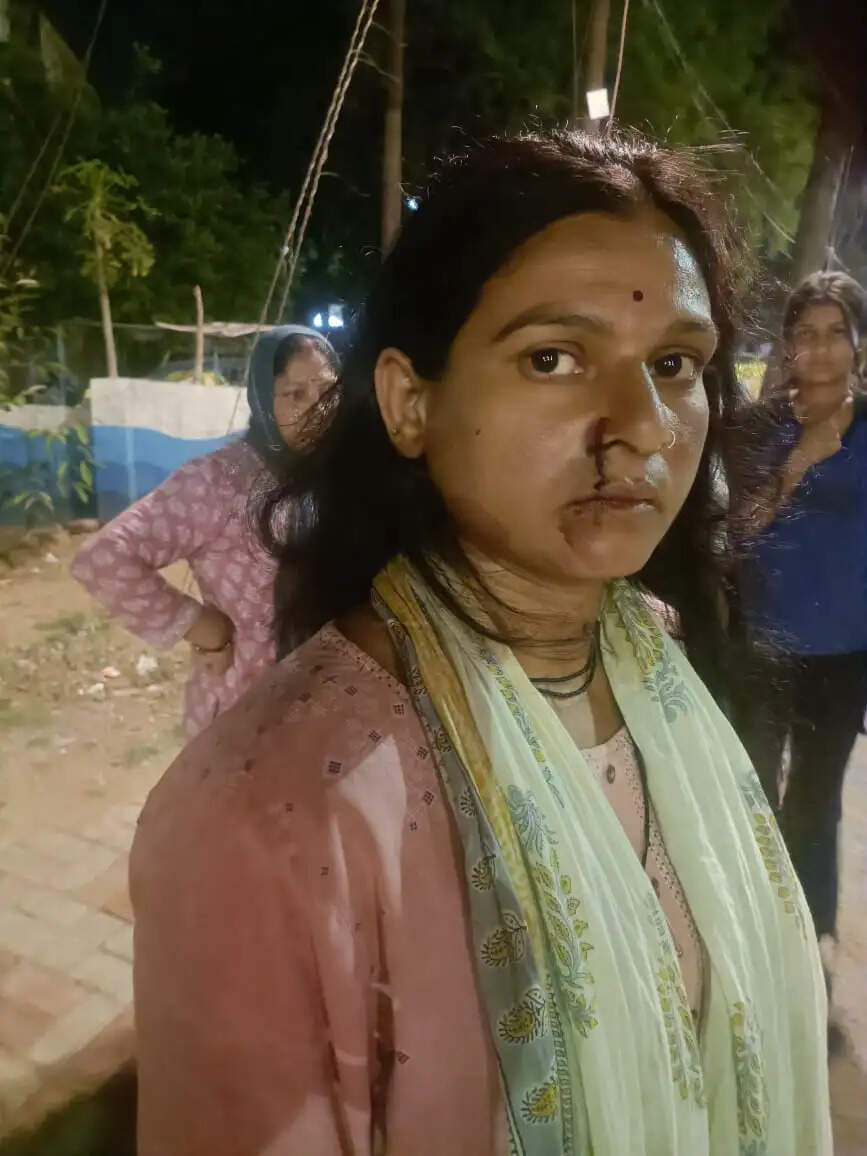 रक्सा पुलिस का कारनामा : घर में घुसकर महिला से मारपीट और उसी के रिश्तेदार का किया चालान