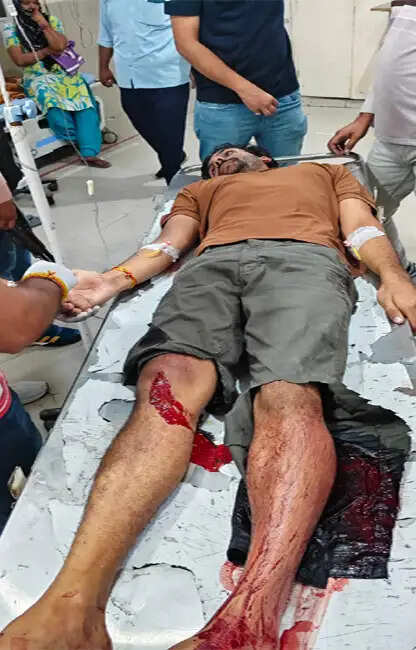 सोनीपत: हरियाणवी गायक की रेंज रोवर पर फायरिंग का आरोपी मुठभेड़ में काबू