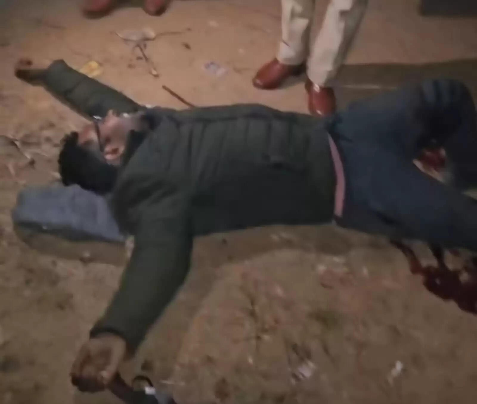 झांसी की महिला ऑटो चालक का हत्यारोपित मुठभेड़ में घायल