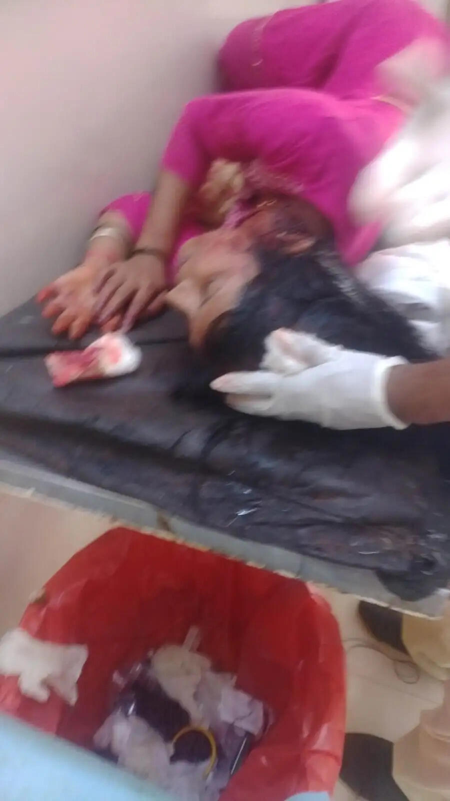 राजगढ़ः थाने में शिकायत से नाराज ससुर ने बहू पर कुल्हाड़ी से किया हमला, सिर में गंभीर चोट