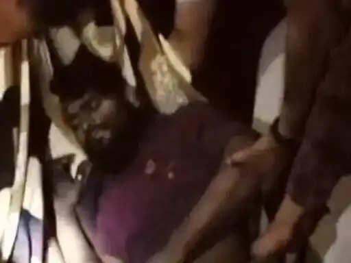 मालगाड़ी की चपेट में आया ट्रक चालक, दाहिना पैर कटा; रेलवे ट्रैक पार करते समय हुआ हादसा