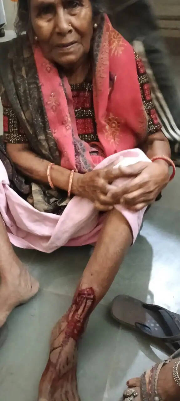 श्योपुरः वीरपुर के नहेलापुरा में जाटव-रावत समाज के बीच खूनी संघर्ष, लाठी-डंडो व कुल्हाड़ी से किया हमला