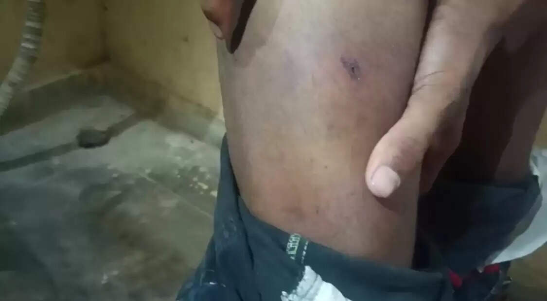 मुसाफिरखाना कोतवाली की बेरहम पुलिस का नया कारनामा!