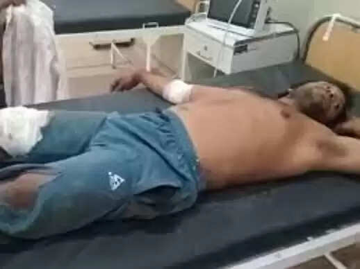 सीधी&nbsp;में&nbsp;तेज&nbsp;रफ्तार&nbsp;ऑटो पलटा,&nbsp;एक ही परिवार के चार लोग घायल&nbsp;