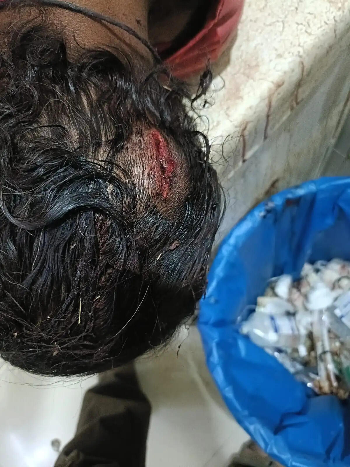 राजगढ़ः युवक पर डंडे से हमला कर चार बकरे लूट ले गए बदमाश