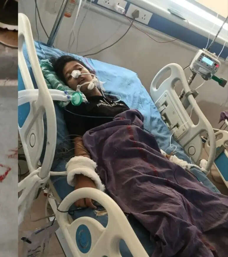 हिसार : नवोदय विद्यालय हॉस्टल में सांप ने छात्रा को डसा, गंभीर