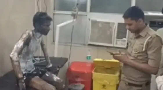 प्रेम प्रसंग के आरोप में युवक पर पेट्रोल डालकर जिन्दा जलाने का प्रयास