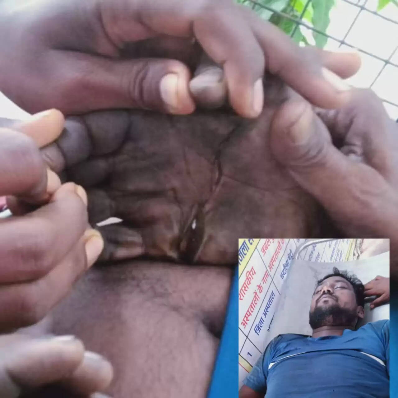 अनूपपुर: सर रिसोर्ट एंड फन सिटी वॉटर पार्क में फिर एक मौत, सुरक्षा पर सवाल