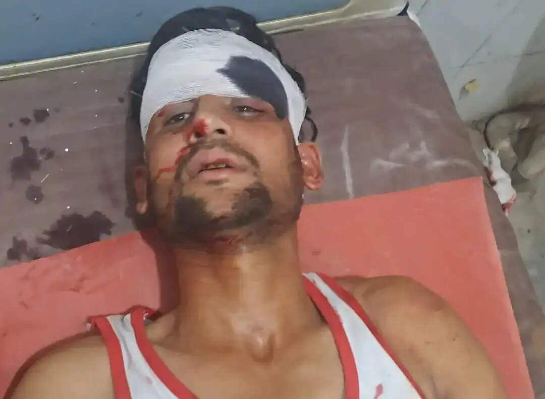 ट्रक की टक्कर से युवक घायल