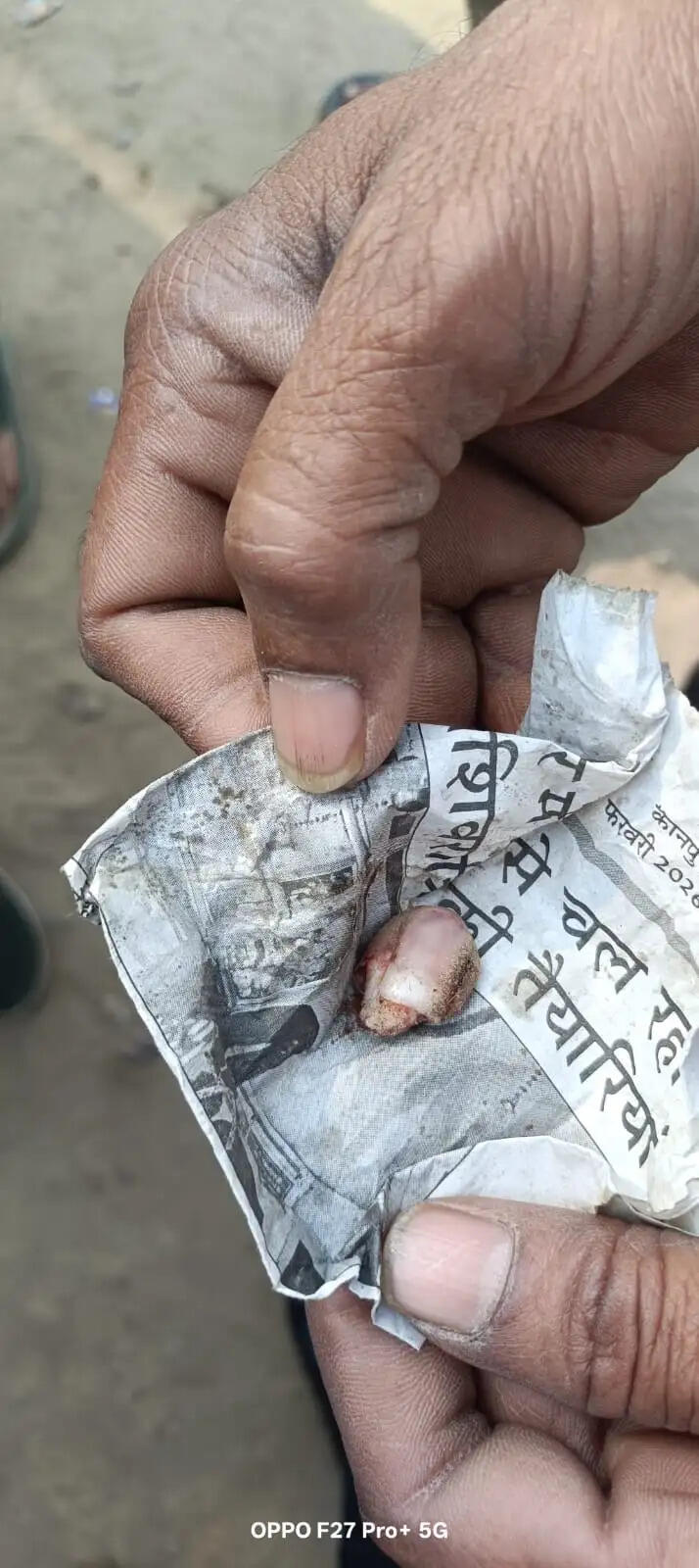 सिगरेट के पैसे मांगने पर ग्राहक ने दुकानदार की उंगली चबायी, पुलिस ने हिरासत में लिया