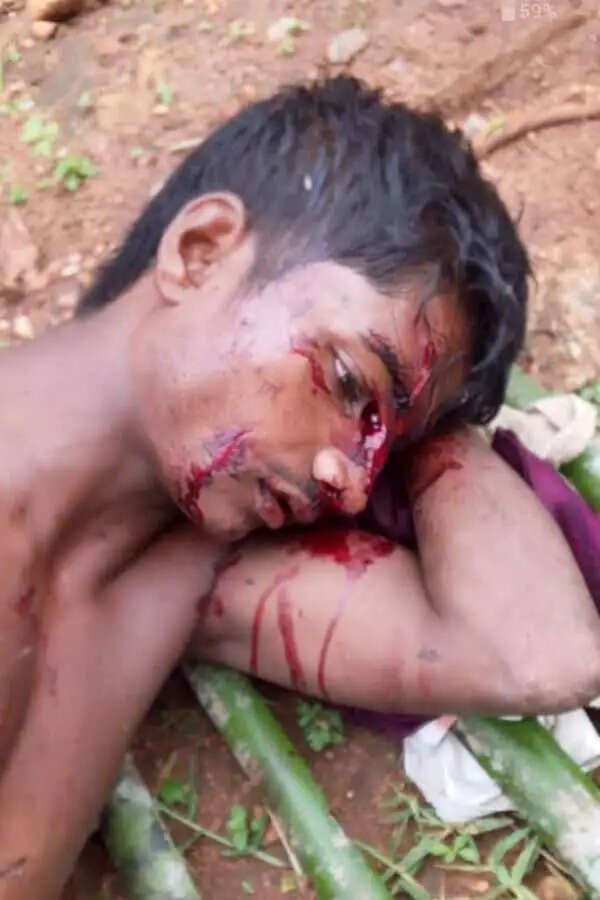 बीजापुर में चरवाहे युवक पर वन्य प्राणी भालू ने किया हमला
