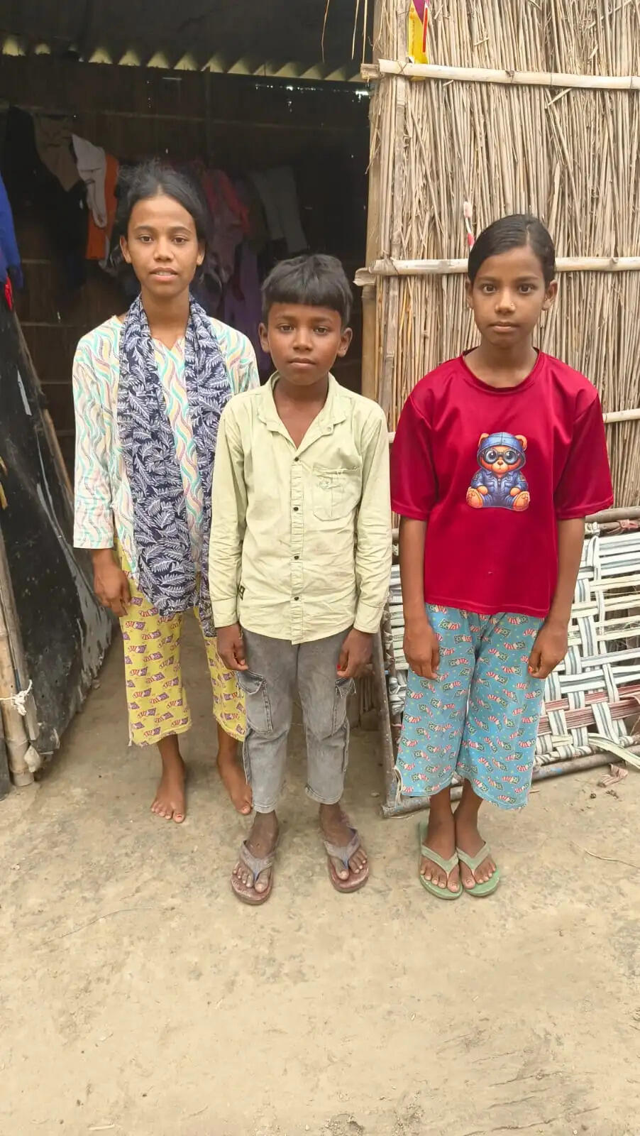 बिहार में सीवान जिले के बिंद टोली में चिकन पॉक्स का विस्फोट, हर घर में मरीज