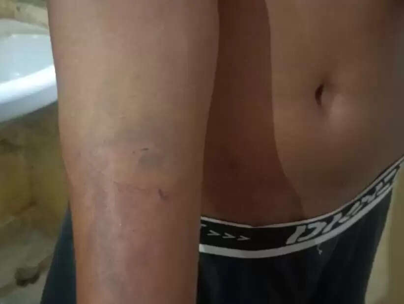 मुसाफिरखाना कोतवाली की बेरहम पुलिस का नया कारनामा!