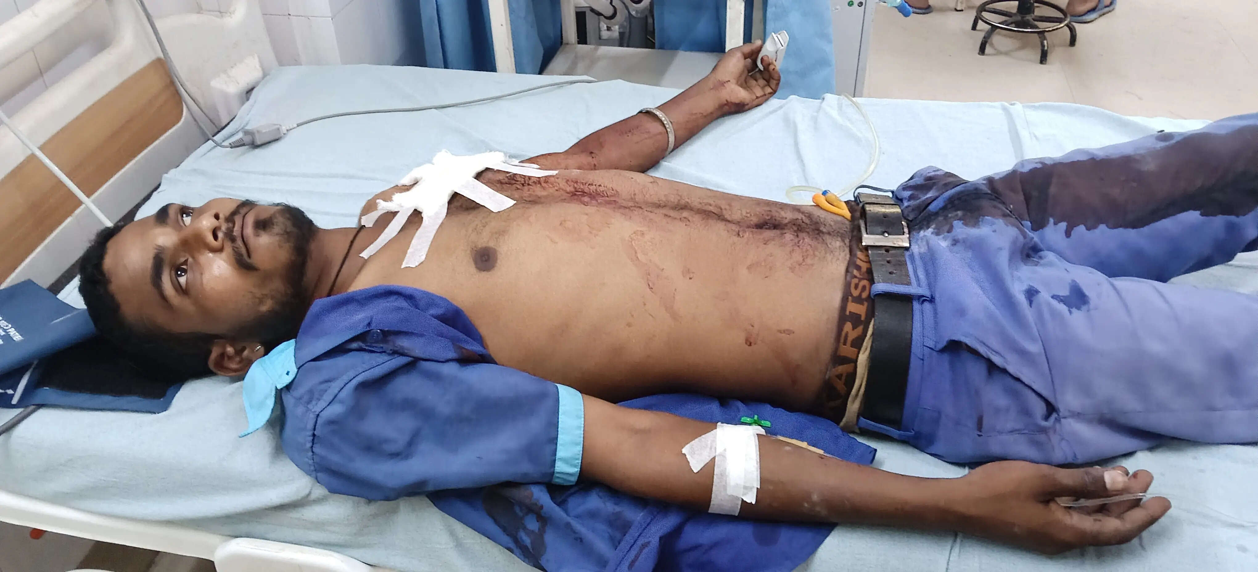 अलवर में पेट्रोल पंप के सेल्समैन को गोली मारकर फरार हुआ बदमाश, नाकेबंदी में आरोपित गिरफ्तार