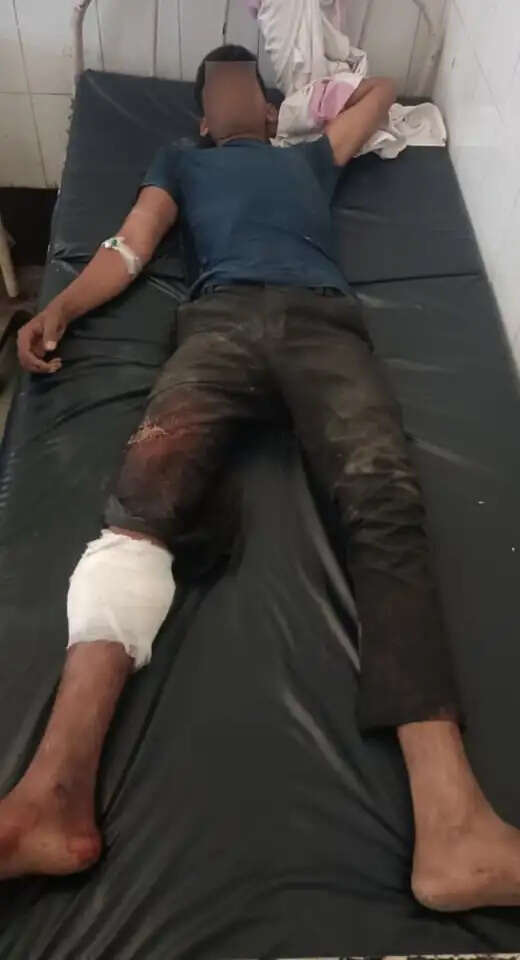 मुठभेड़ में 25 हजार का इनामी गिरफ्तार, गोली लगी