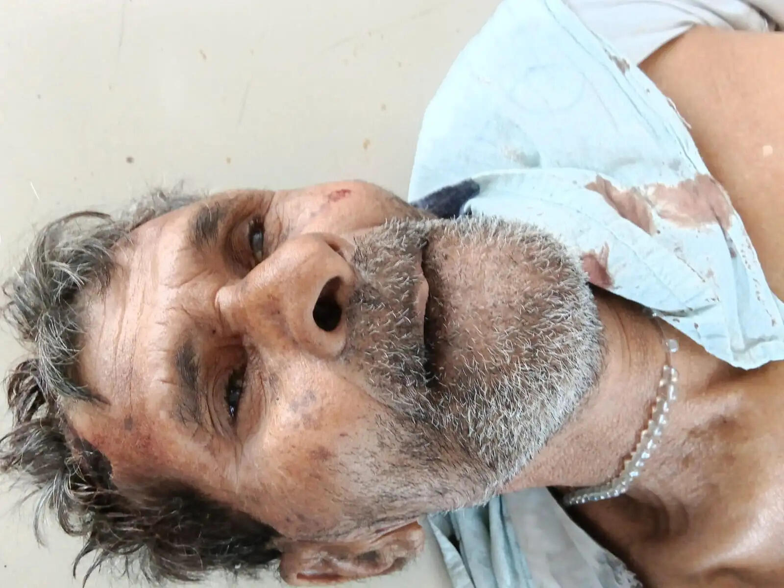 राजगढ़ः बाइक-साइकिल की टक्कर में बुजुर्ग की मौत, दो युवक घायल