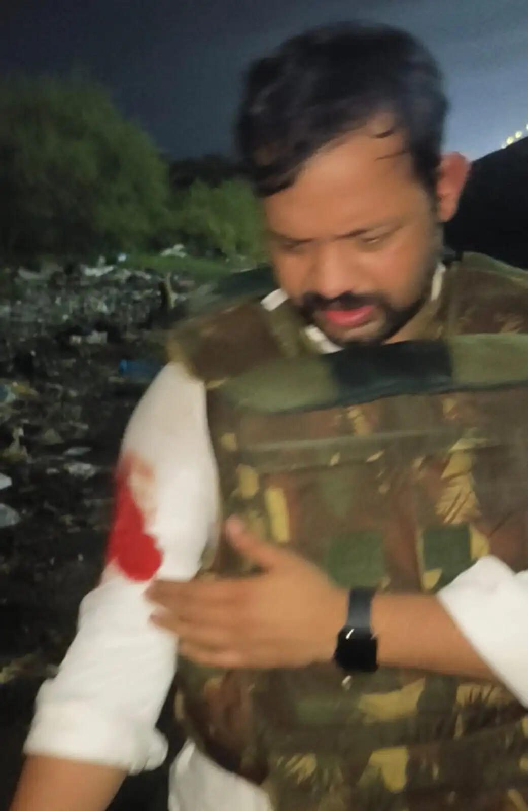वाराणसी: बदमाशों से मुठभेड़ में एसओजी प्रभारी घायल, चांदी लूटकांड के दो आरोपितों को पैर में लगी गोली