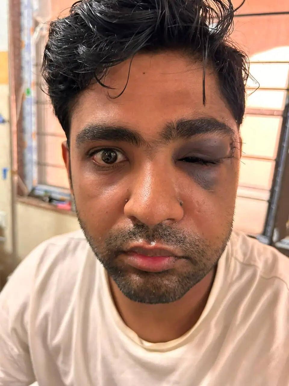 एमडीएम हॉस्पिटल में जटिल चेहरे की सर्जरी सफल