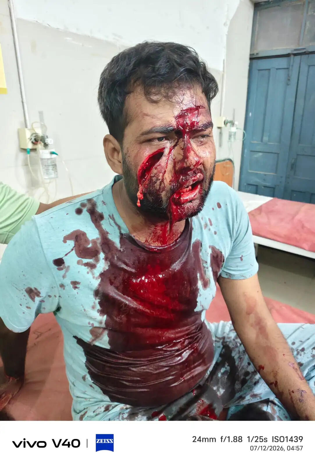 जमीन बंटवारे के विवाद में खूनी संघर्ष, चाचा ने कुल्हाड़ी से हमला कर दो भतीजों को किया गंभीर रूप से घायल