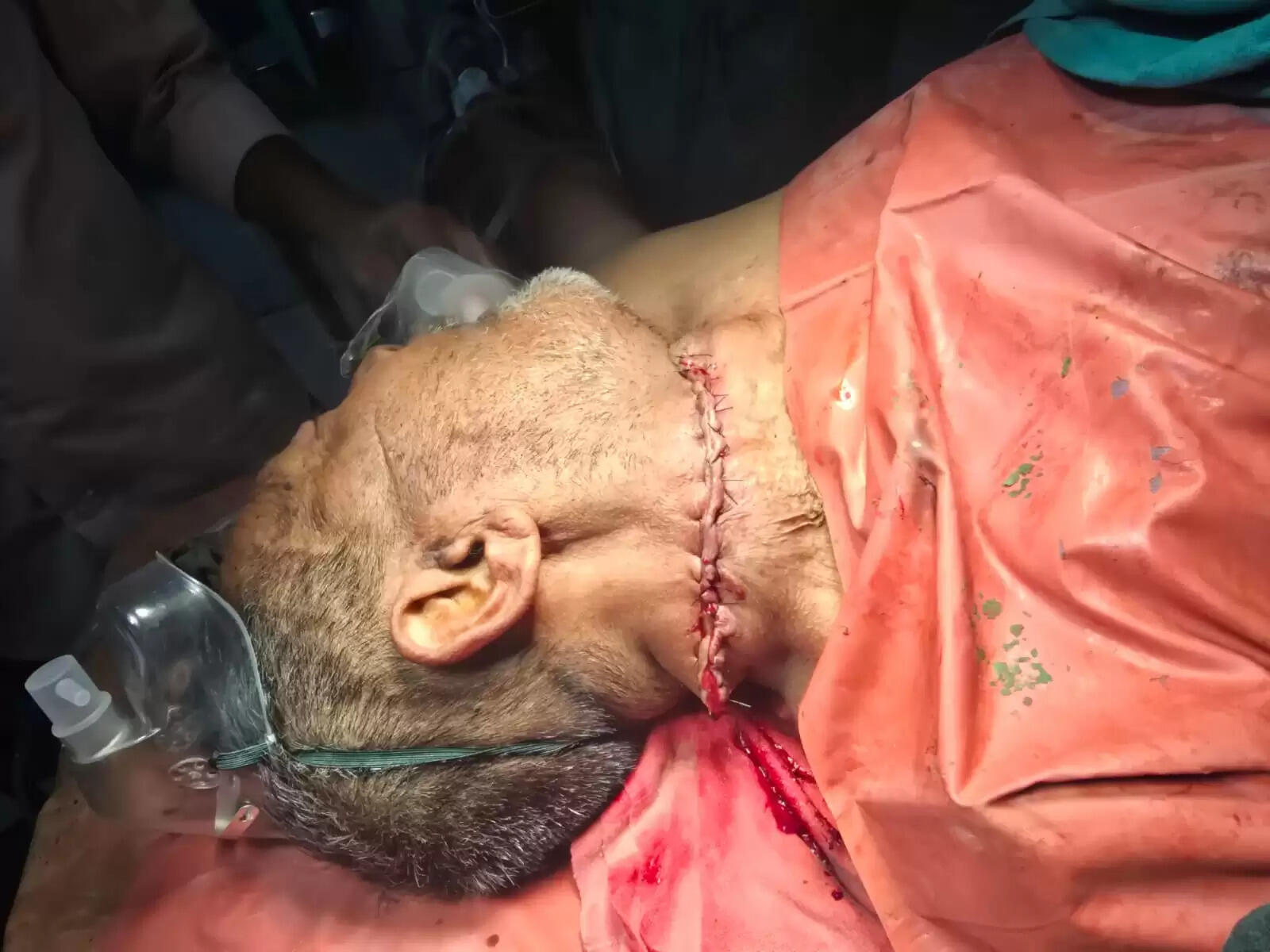 मानवता की मिसाल: गुरुदेव मुखिया का जीएमसीएच पूर्णिया में सफल ऑपरेशन