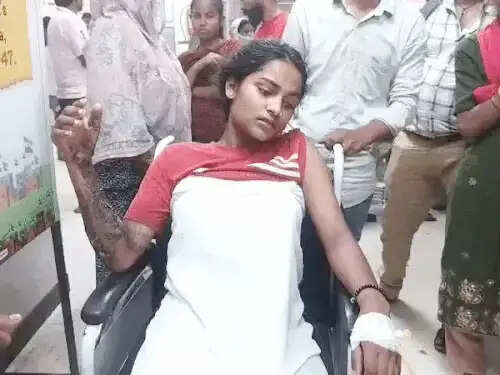फरीदाबाद : युवती को बंधक बनाकर खौलते पानी से जलाया, दिल्ली रैफर