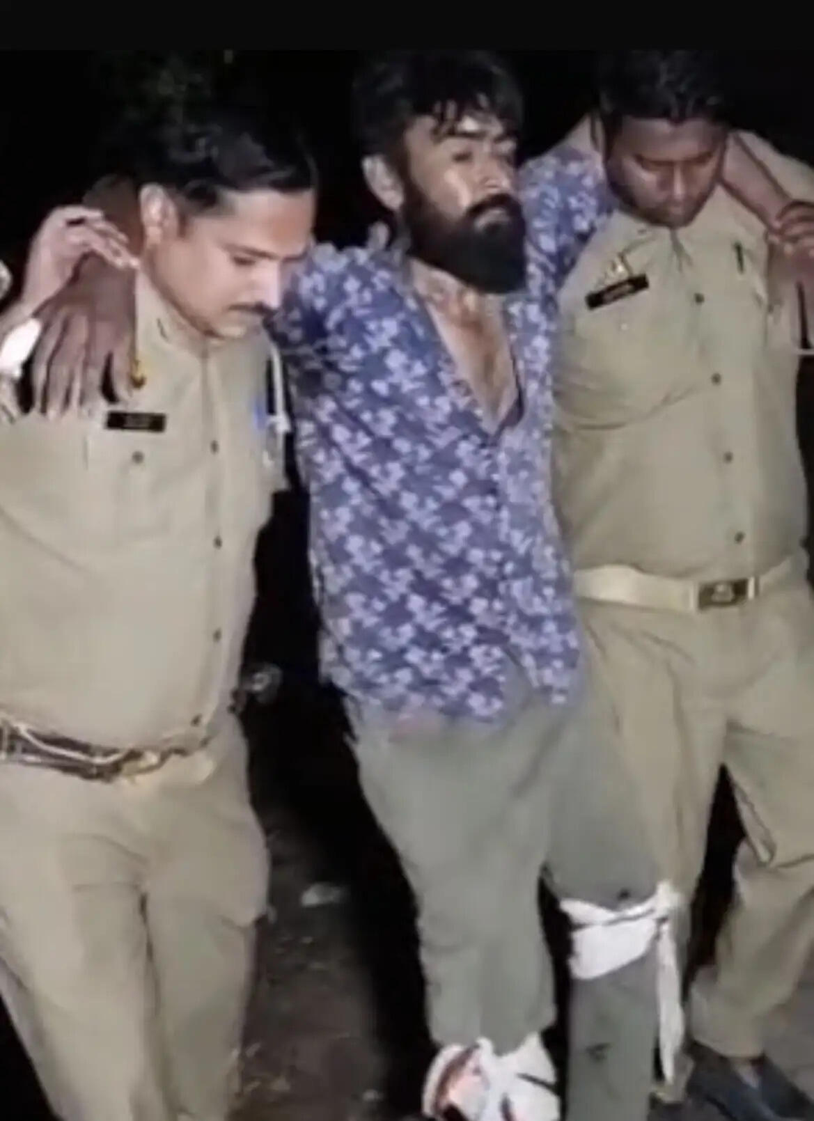 युवक पर चाकू से हमला करने वाला आरोपित पुलिस मुठभेड़ में गिरफ्तार, दोनों के पैर में लगी गोली